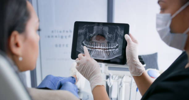 Licensed Teeth Whitening service in Arial, SC - Smile Center Dentistry